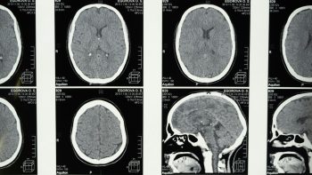 Increasing Access to Psychedelics: SOAA Leads the Charge